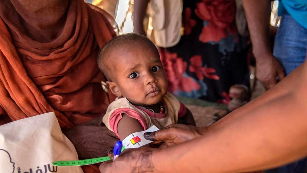 যুদ্ধবিধ্বস্ত সুদানে অপুষ্টি ও খাদ্যসংকটে শিশুমৃত্যুর সংখ্যা বাড়ছে। ছবি: সংগৃহীত